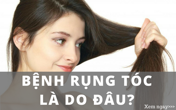 Bệnh rụng tóc là do đâu?
