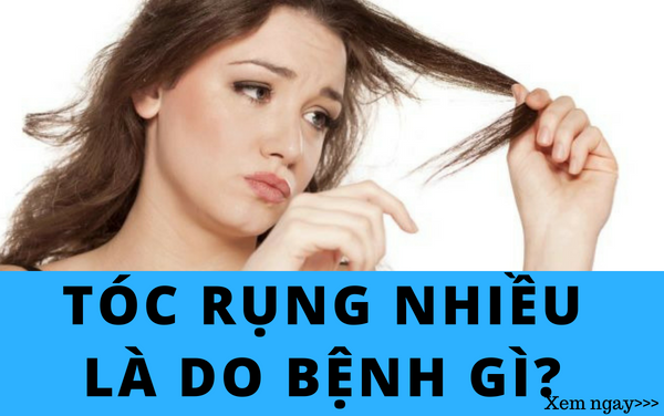 Tóc rụng nhiều là do bệnh gì???