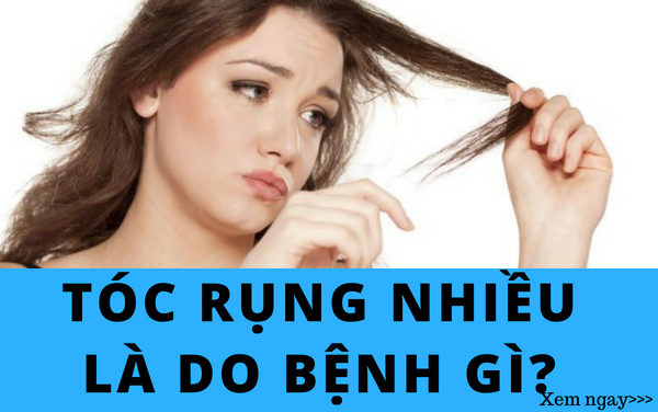 Tóc rụng nhiều là do bệnh gì???