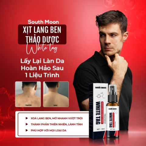 Xịt lang ben, bạch biến Southmoon