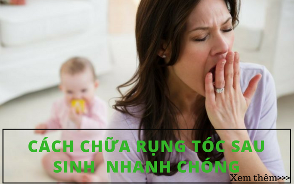 Cách chữa rụng tóc sau sinh nhanh chóng