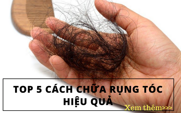 Top 5 cách chữa rụng tóc hiệu quả